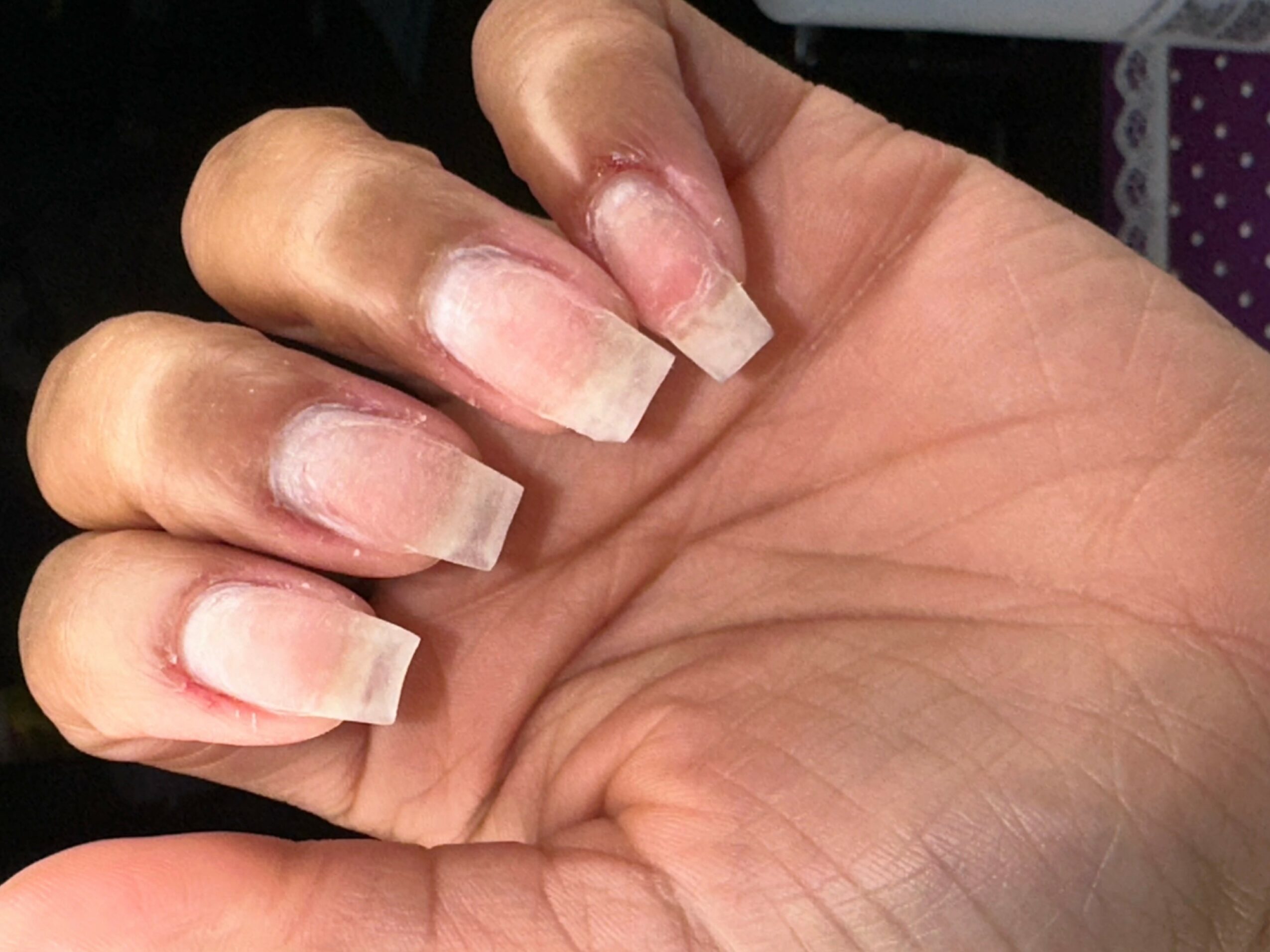Close-up of a hand with long, natural nails and visible skin lines.