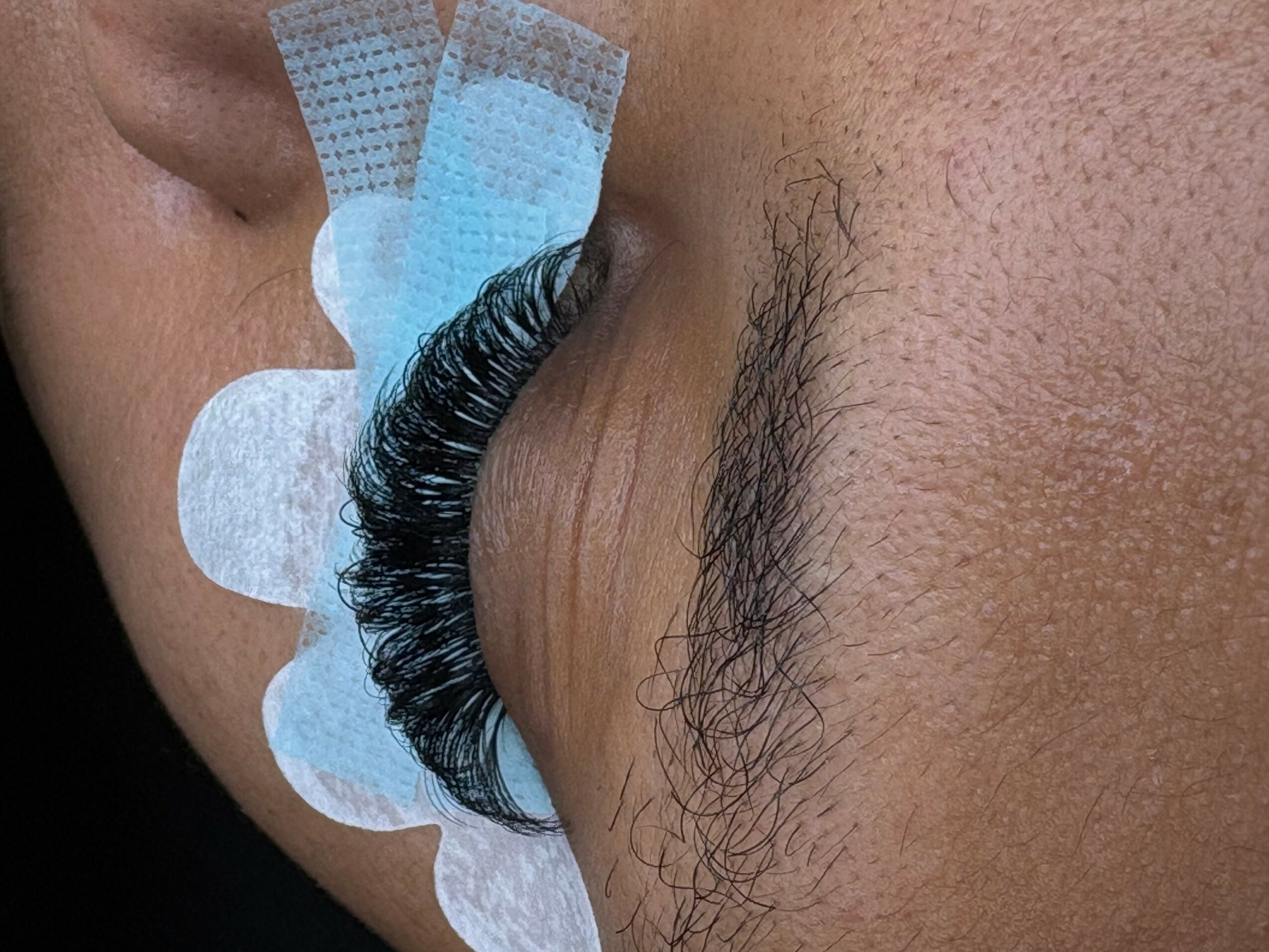 Close-up of a person's eye with a false eyelash extension and medical tape near the eye, skin with visible pores.