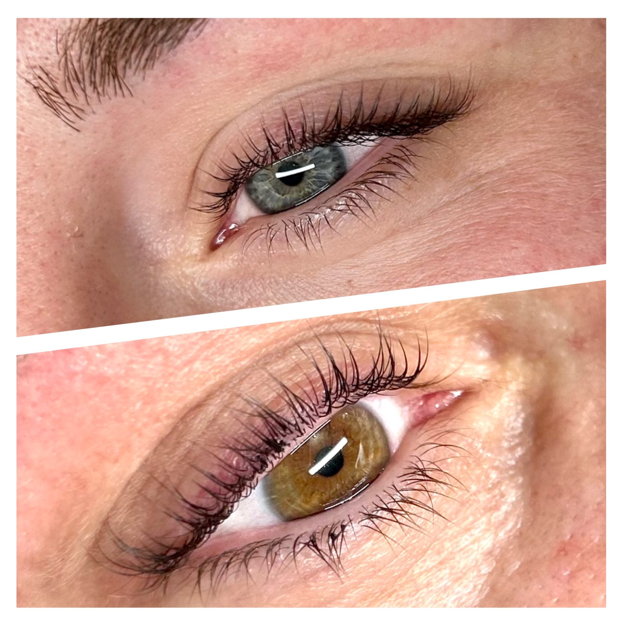 Close-up of two eyes, one with blue iris and the other with brown iris, showing eyelashes and skin texture.