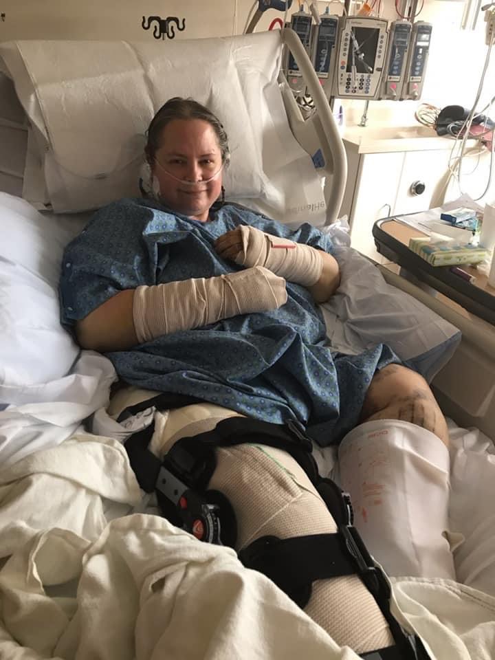 Woman in hospital bed with medical equipment, smiling, wearing hospital gown and gloves, with leg brace and medical devices nearby.