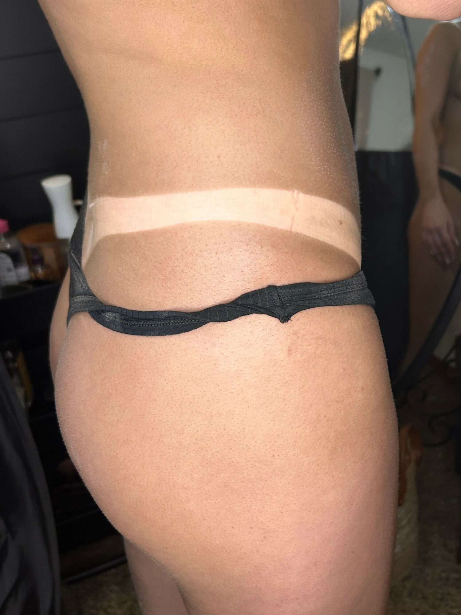 Close-up of a person's upper thigh with a black strap and a beige band around the thigh.