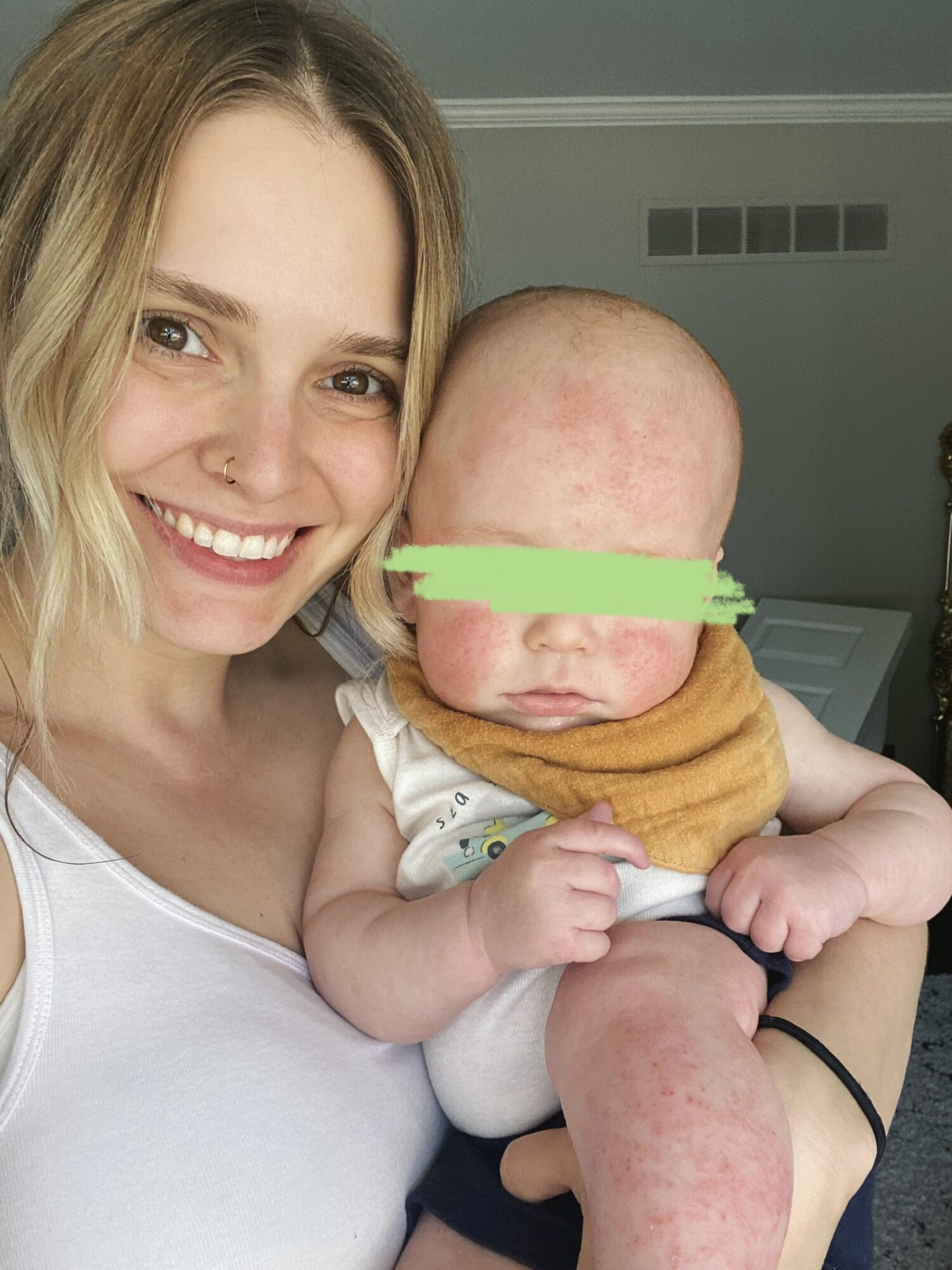 Woman smiling holding a baby with a red, irritated face, both looking at the camera, indoors.