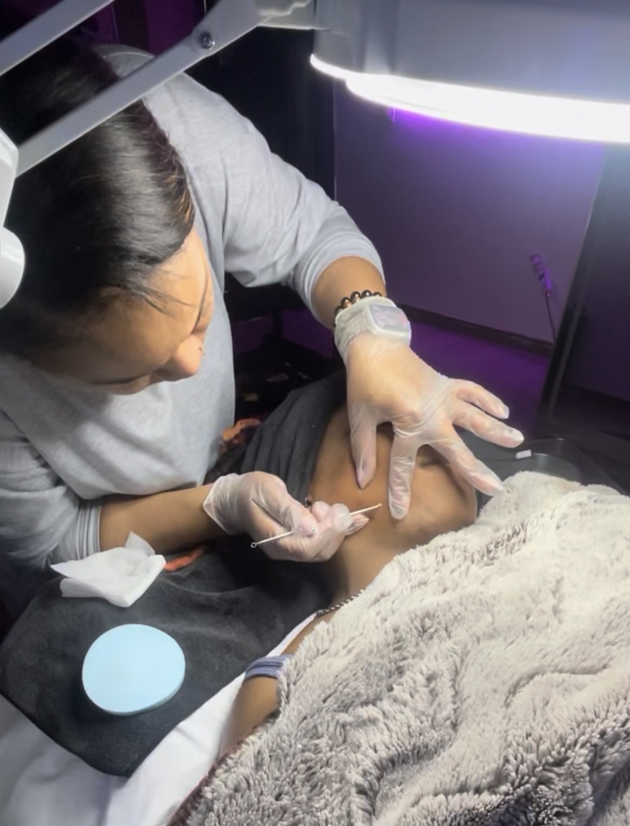 Medical professional examining a patient's arm under a bright light, wearing gloves and a watch.