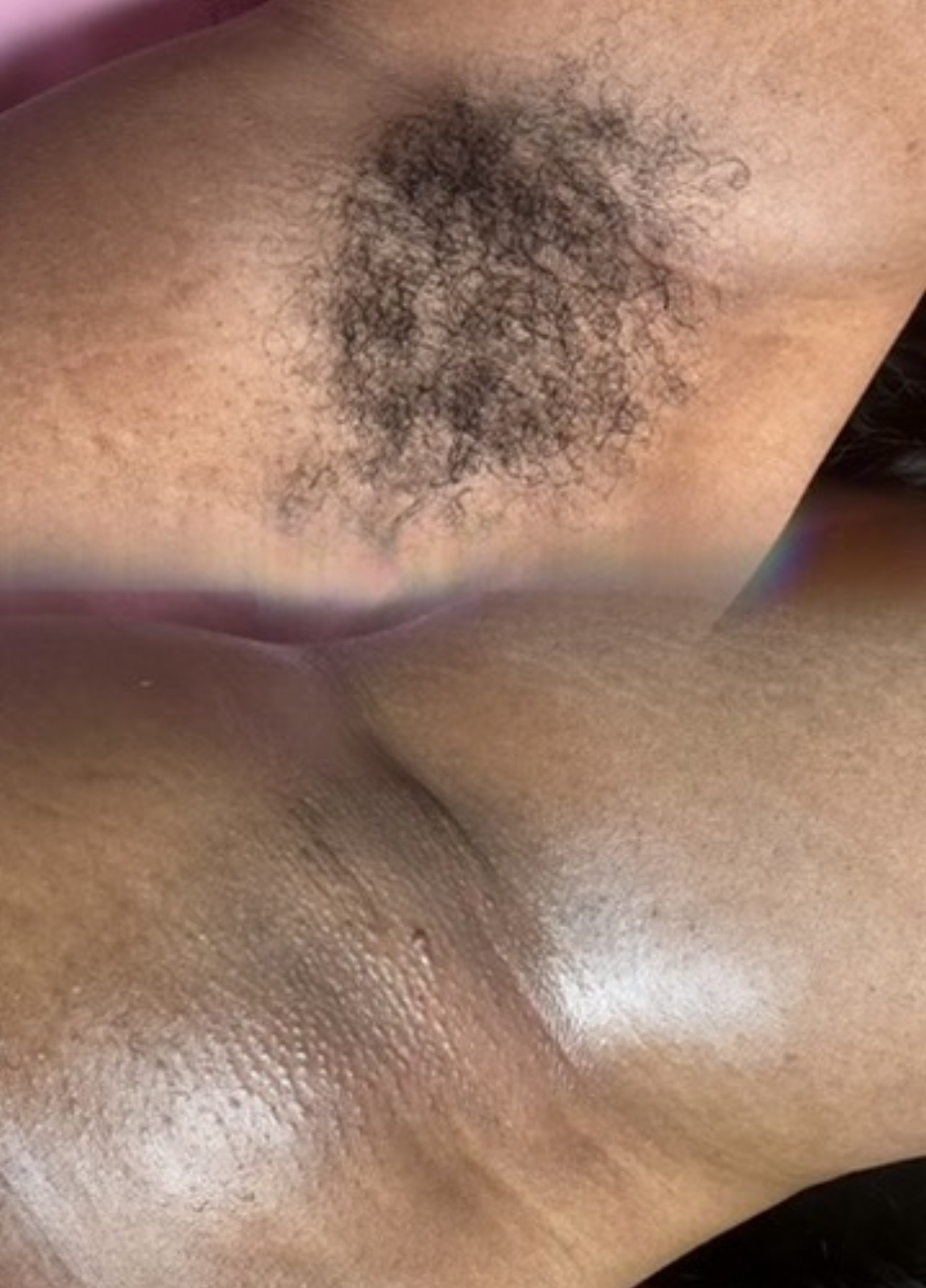 Close-up of a person's armpit with dark hair and skin texture visible.