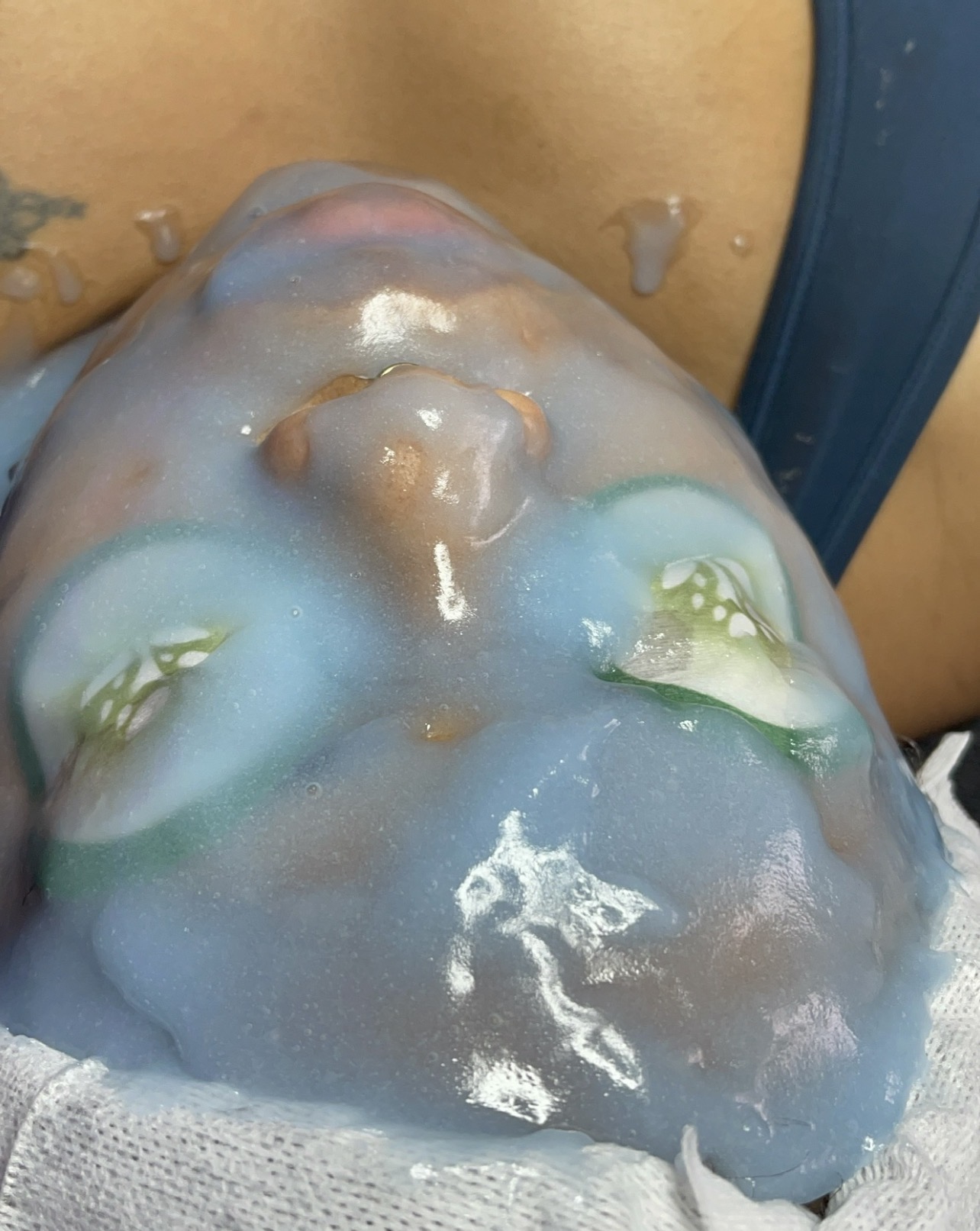 Person receiving facial treatment with blue and white mask, eyes covered, lying down, skin visible around face.